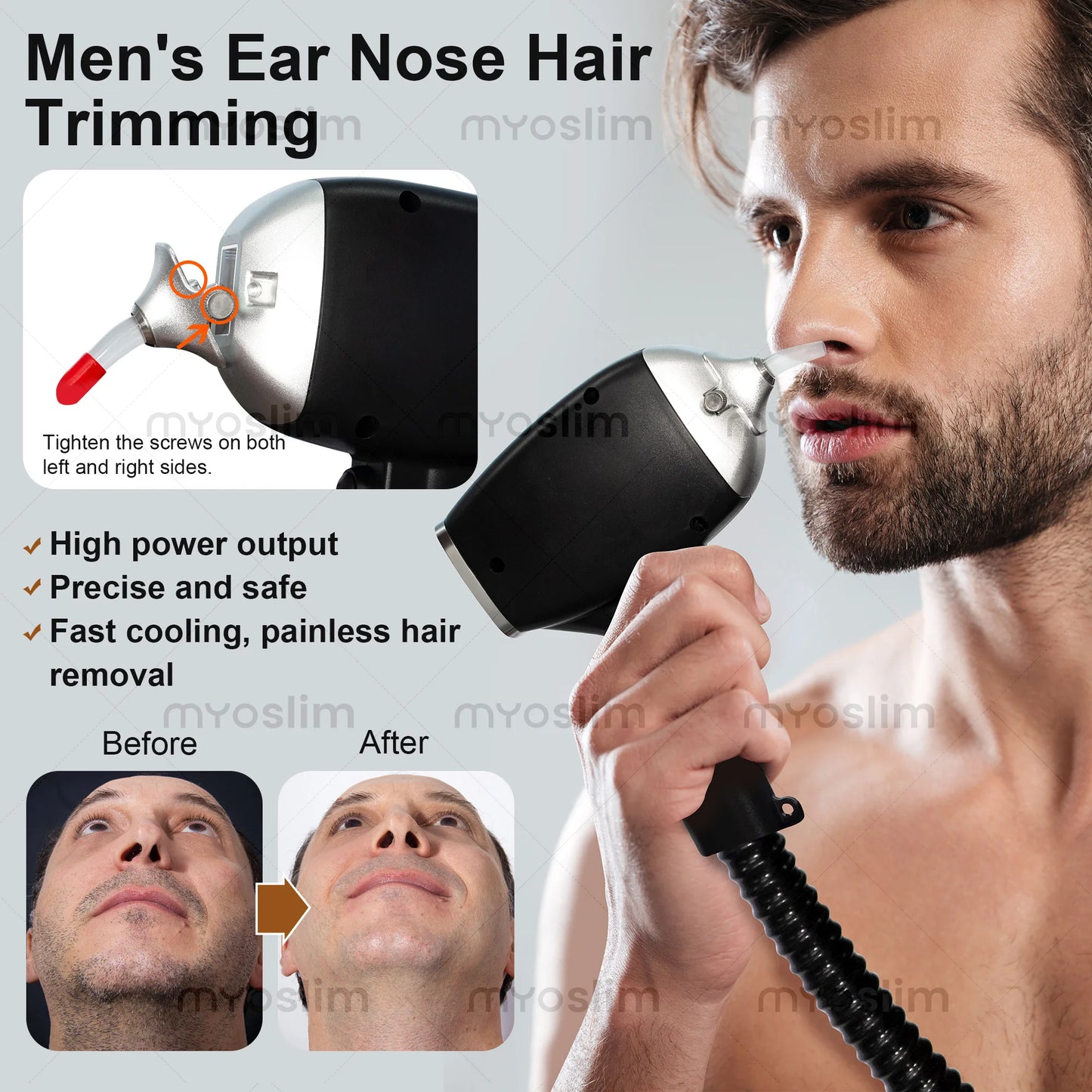 5000W FAC Diode Hair Removal 755 808 940 1064nm Soprano Painless Permanent Hair Removal CE Certified Alexandrite Device