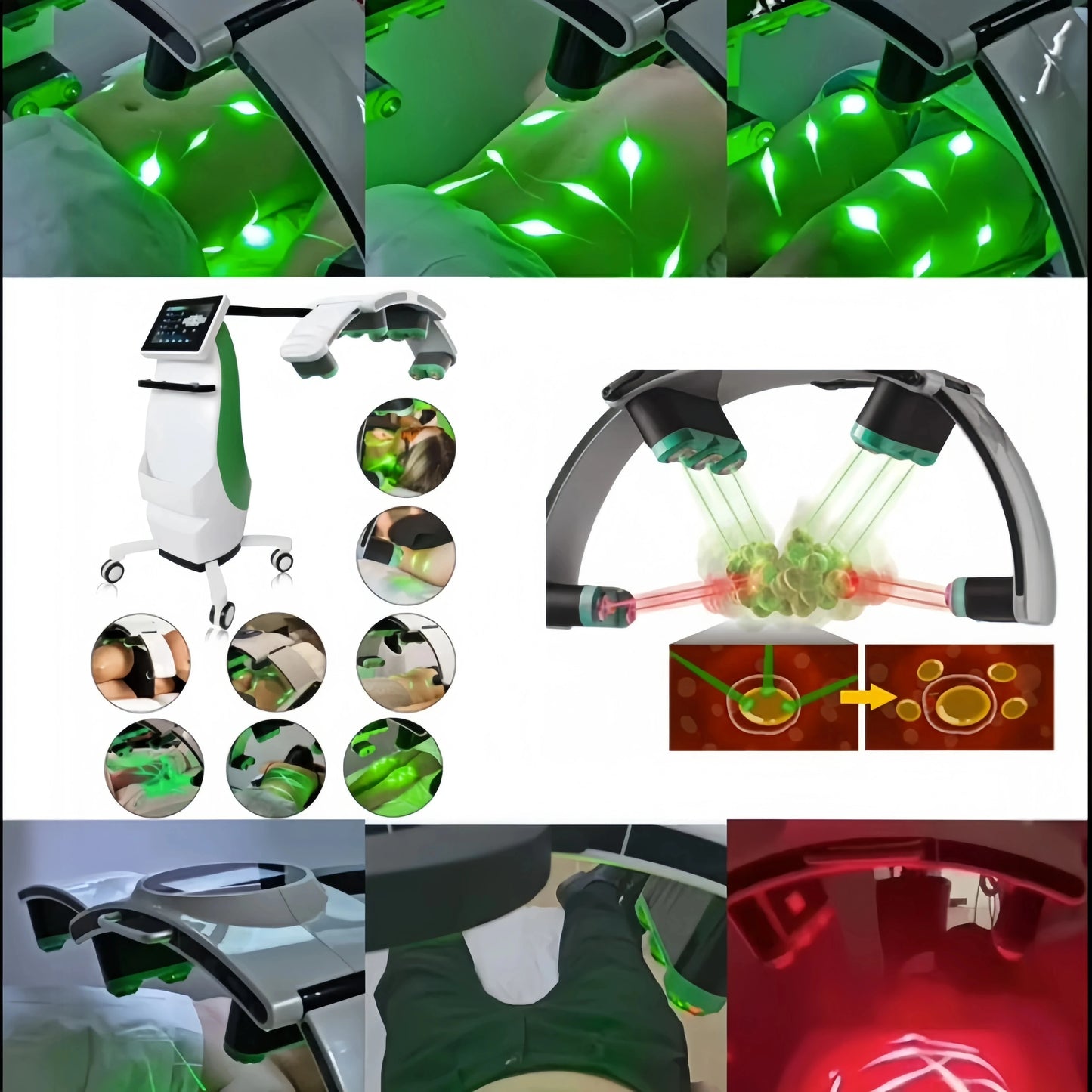 2026 Newest 10D Emerald Laser Painless 532nm green and red light Fat Weight Loss Body Shaping Slimming