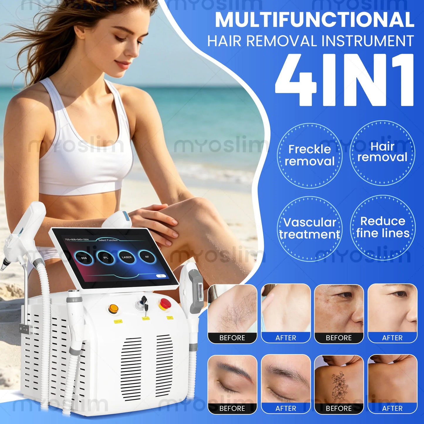 Diode Hair Removal 4 IN 1 5000W FAC 755 808 940 1064nm Soprano Painless Permanent Hair Removal CE Certified Beauty Device